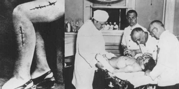experimente făcute de naziștii lui Hitler