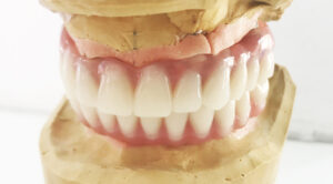 coroane-dentare-maxilar-mandibula-rana-art-dent