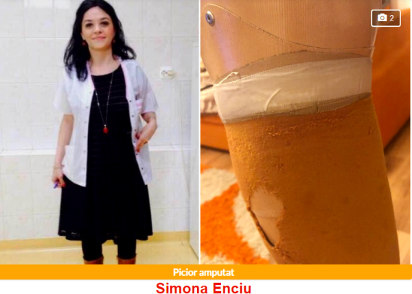 Oficial Media - Cu un picior amputat, Simona Enciu are nevoie de o proteză pentru a duce o viață normală