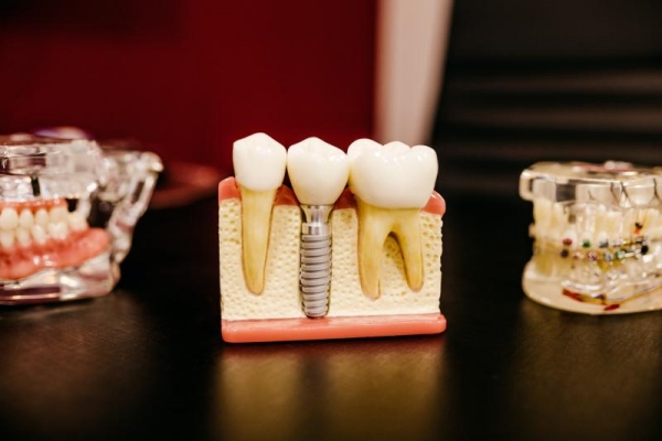 5 avantaje ale ortodonției